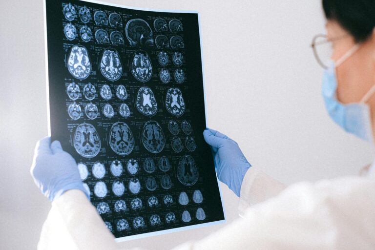 a doctor holding an mri result of the brain